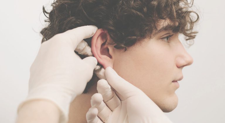 Otoplastia-dra-ana-de-la-concepcion