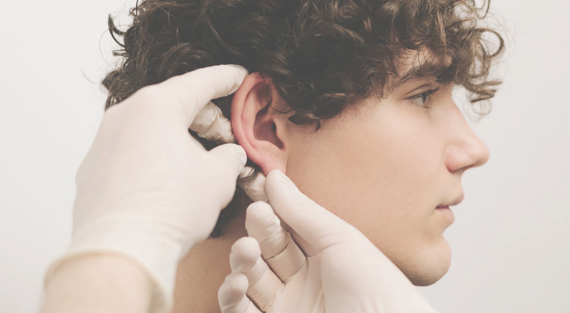 Otoplastia-dra-ana-de-la-concepcion